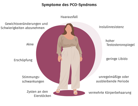 Illustration einer Frau mit braunem Haar, umgeben von deutschem Text, der die Symptome von PCOS auflistet, wie Haarausfall, Insulinresistenz, Akne, Müdigkeit, Stimmungsschwankungen und unregelmäßige Perioden.